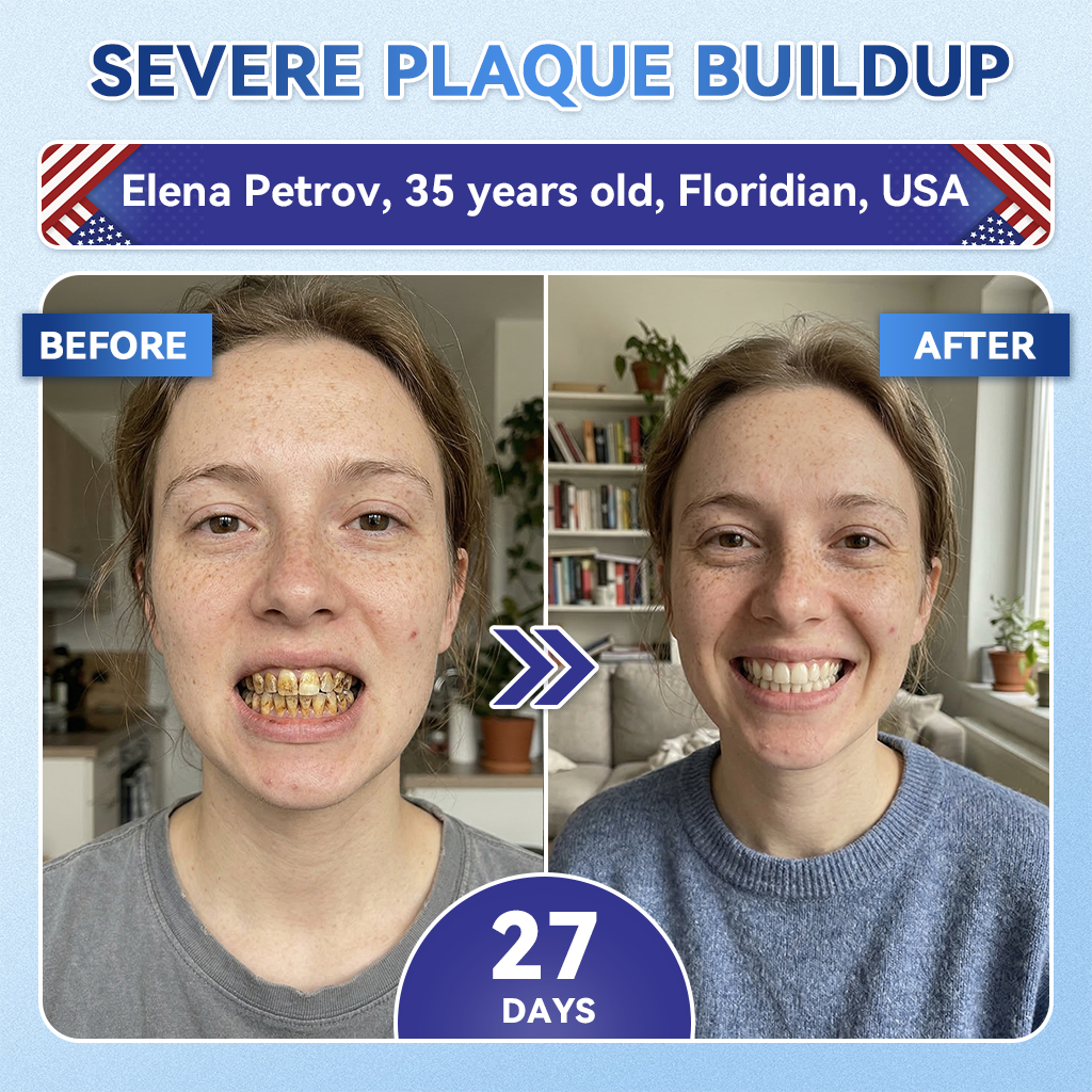 Your Smile~ Acezozla® 🦷 Tideglusib Fast‑Dissolving Tooth & Gum Repair Oral Strips ✨ (𝟓-𝐢𝐧-𝟏 💎 𝐑𝐞𝐛𝐮𝐢𝐥𝐝 𝐄𝐧𝐚𝐦𝐞𝐥 & 𝐃𝐞𝐧𝐭𝐢𝐧 • 𝐒𝐭𝐫𝐞𝐧𝐠𝐭𝐡𝐞𝐧 𝐆𝐮𝐦𝐬 • 𝐄𝐫𝐚𝐝𝐢𝐜𝐚𝐭𝐞 𝐓𝐚𝐫𝐭𝐚𝐫 & 𝐎𝐝𝐨𝐫 • 𝐖𝐡𝐢𝐭𝐞𝐧𝐢𝐧𝐠 • 𝐒𝐭𝐨𝐩 𝐓𝐨𝐨𝐭𝐡 𝐒𝐞𝐧𝐬𝐢𝐭𝐢𝐯𝐢𝐭𝐲)