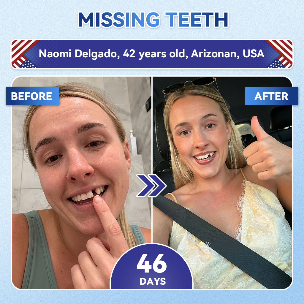 Your Smile~ Acezozla® 🦷 Tideglusib Fast‑Dissolving Tooth & Gum Repair Oral Strips ✨ (𝟓-𝐢𝐧-𝟏 💎 𝐑𝐞𝐛𝐮𝐢𝐥𝐝 𝐄𝐧𝐚𝐦𝐞𝐥 & 𝐃𝐞𝐧𝐭𝐢𝐧 • 𝐒𝐭𝐫𝐞𝐧𝐠𝐭𝐡𝐞𝐧 𝐆𝐮𝐦𝐬 • 𝐄𝐫𝐚𝐝𝐢𝐜𝐚𝐭𝐞 𝐓𝐚𝐫𝐭𝐚𝐫 & 𝐎𝐝𝐨𝐫 • 𝐖𝐡𝐢𝐭𝐞𝐧𝐢𝐧𝐠 • 𝐒𝐭𝐨𝐩 𝐓𝐨𝐨𝐭𝐡 𝐒𝐞𝐧𝐬𝐢𝐭𝐢𝐯𝐢𝐭𝐲)