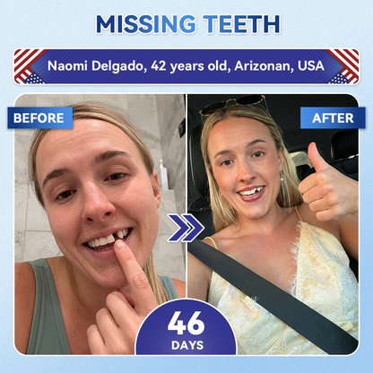 Your Smile~ Acezozla® 🦷 Tideglusib Fast‑Dissolving Tooth & Gum Repair Oral Strips ✨ (𝟓-𝐢𝐧-𝟏 💎 𝐑𝐞𝐛𝐮𝐢𝐥𝐝 𝐄𝐧𝐚𝐦𝐞𝐥 & 𝐃𝐞𝐧𝐭𝐢𝐧 • 𝐒𝐭𝐫𝐞𝐧𝐠𝐭𝐡𝐞𝐧 𝐆𝐮𝐦𝐬 • 𝐄𝐫𝐚𝐝𝐢𝐜𝐚𝐭𝐞 𝐓𝐚𝐫𝐭𝐚𝐫 & 𝐎𝐝𝐨𝐫 • 𝐖𝐡𝐢𝐭𝐞𝐧𝐢𝐧𝐠 • 𝐒𝐭𝐨𝐩 𝐓𝐨𝐨𝐭𝐡 𝐒𝐞𝐧𝐬𝐢𝐭𝐢𝐯𝐢𝐭𝐲)